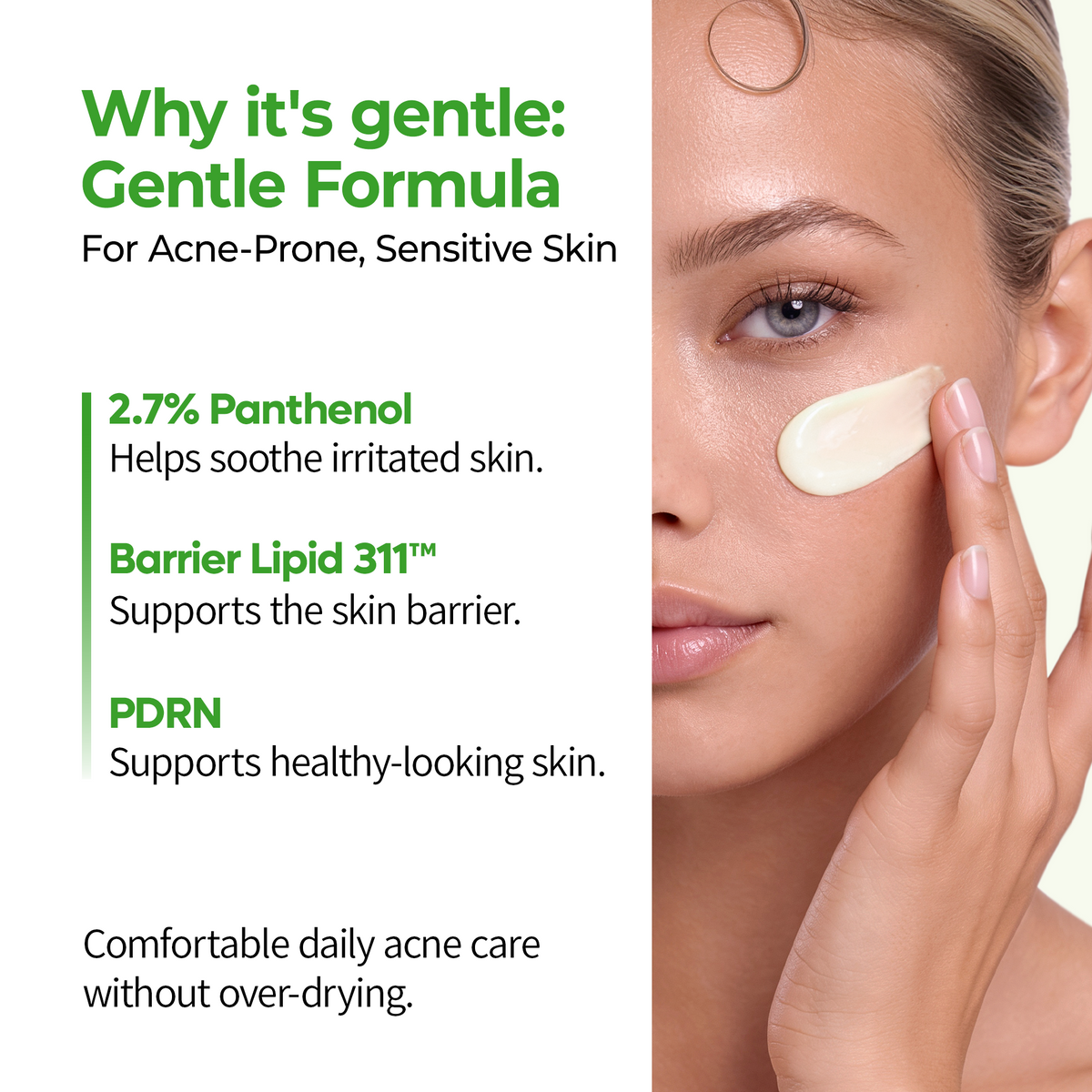 S-ZINC Blemish Cream