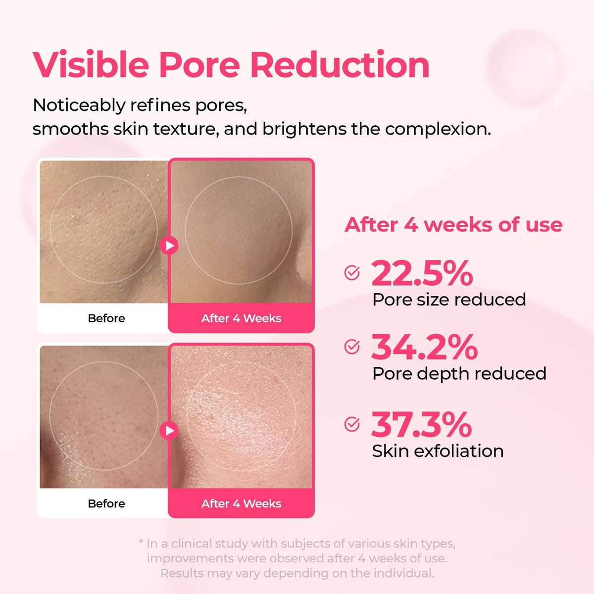 [FREE GIFT] 🏆 ALL-TIME BESTSELLER | 7-Step Radiance Routine Set