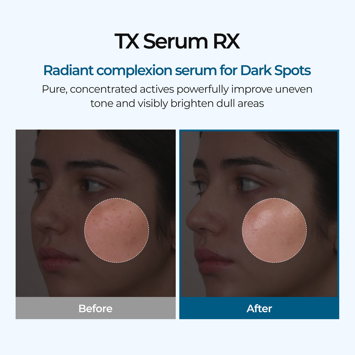 TX Serum Rx