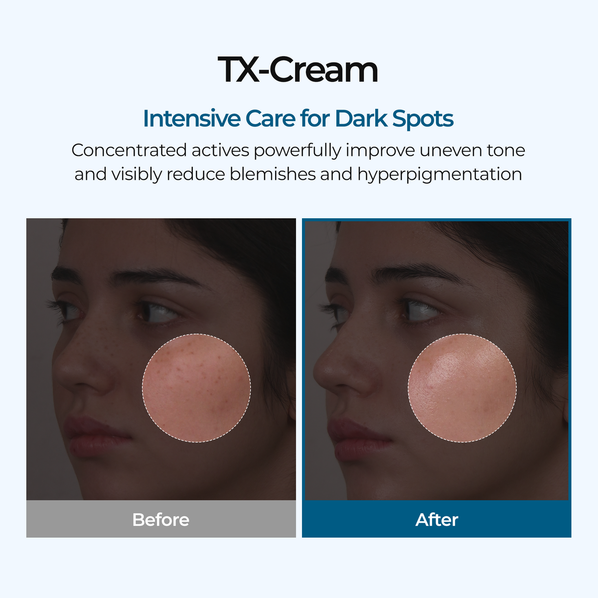 TX Brightening Cream
