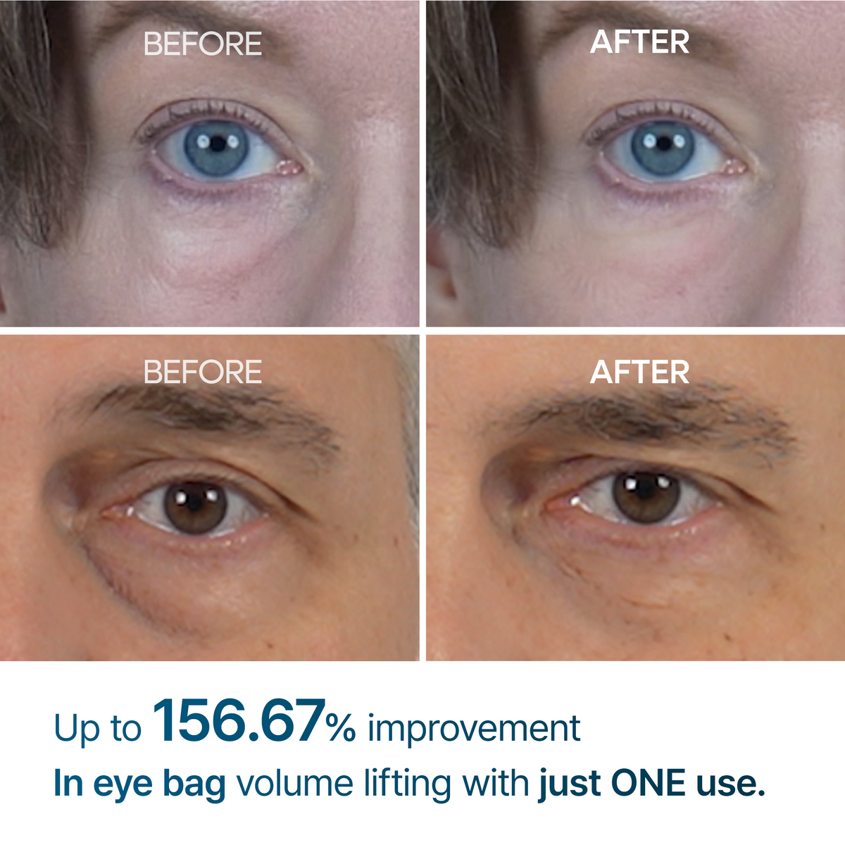BESTSELLER | Eyephalt eyebag cream