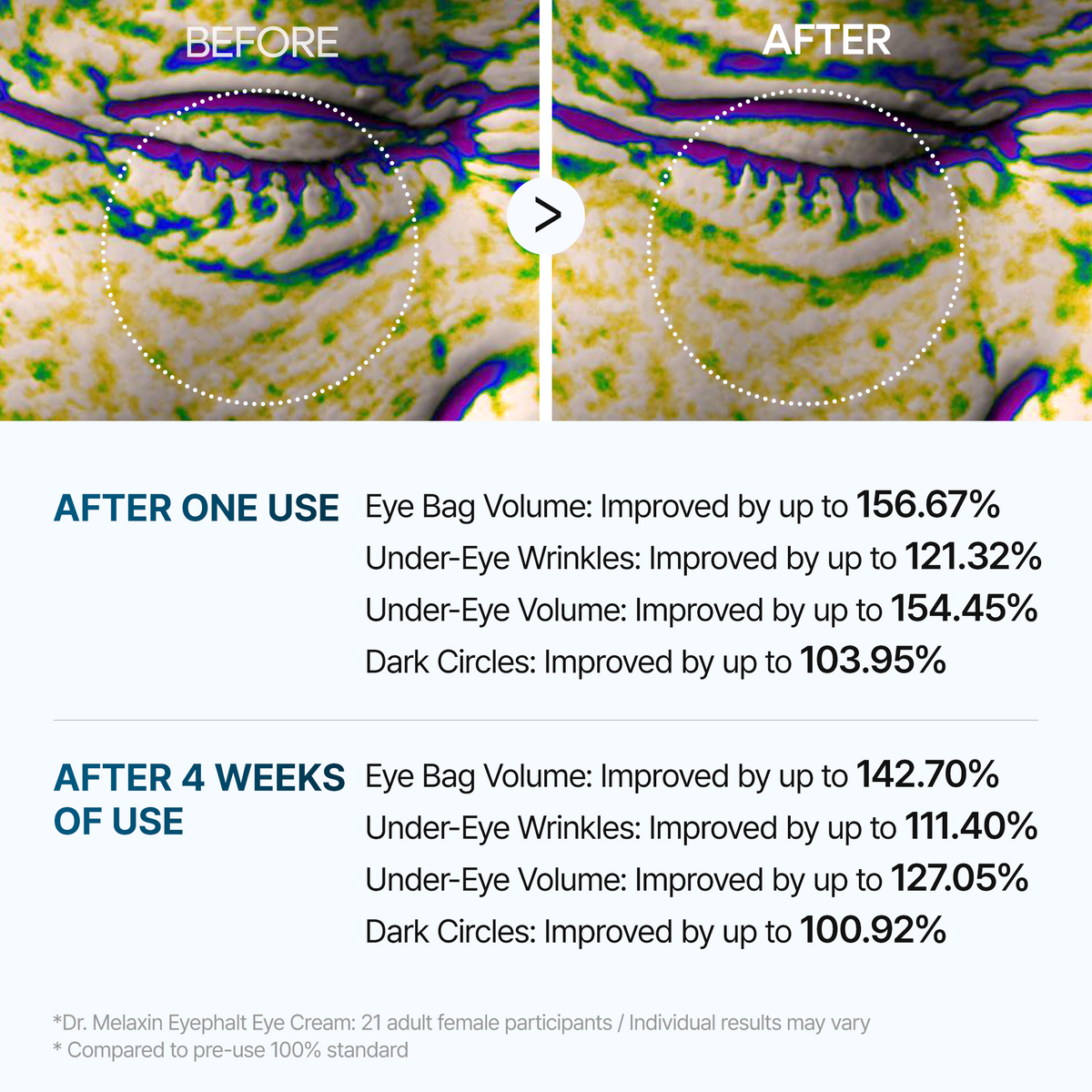 [Day&Night Care] Eyebag Lifting Duo