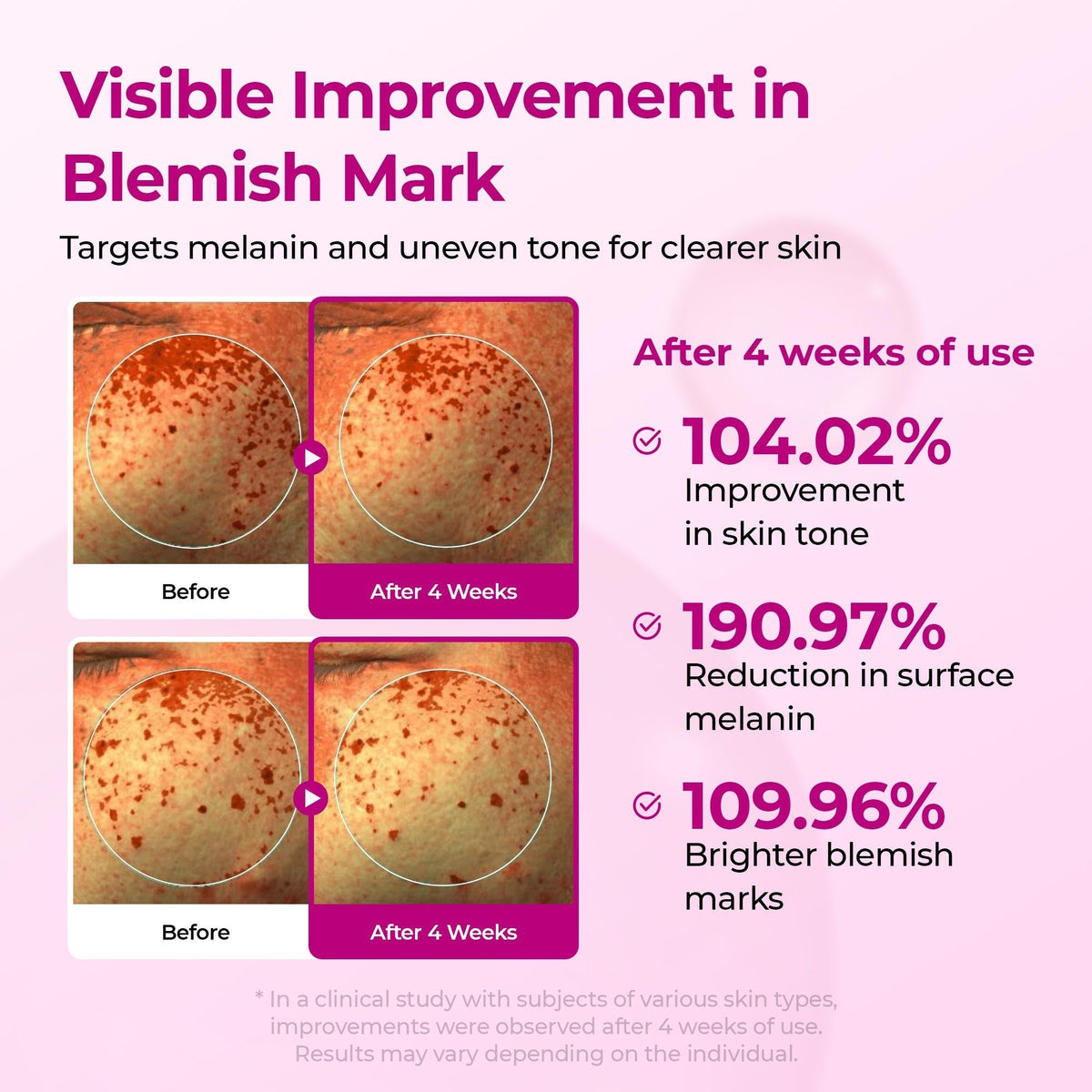 [FREE GIFT] 🏆 ALL-TIME BESTSELLER | 5-Piece Collagen Boost Firming Set