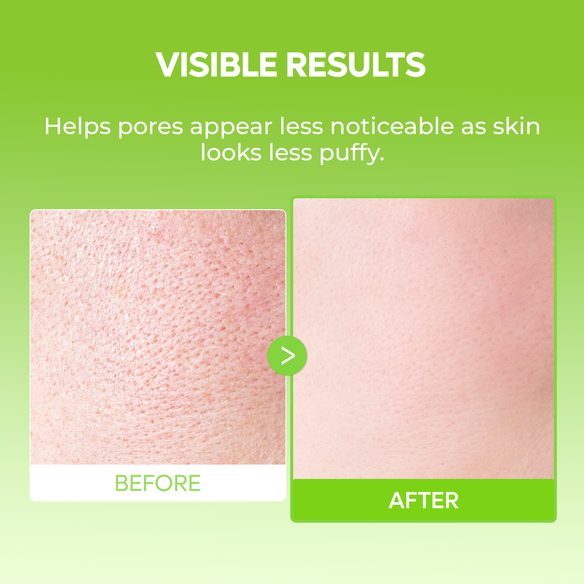 [CLEARANCE SALE] CACTOX De-Puffing Pore Tox Gel Mask 4EA