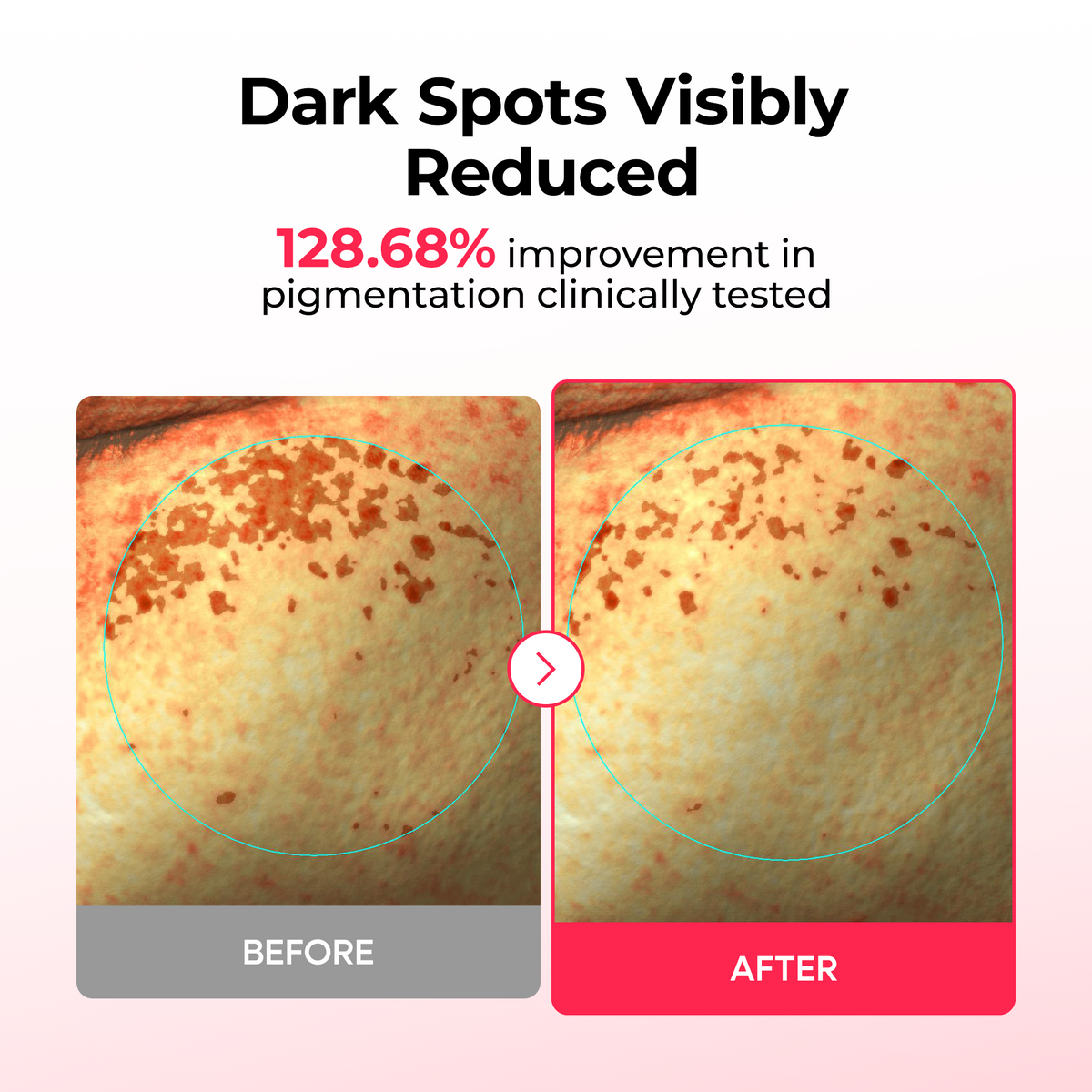 [CLEARANCE SALE] TX Astaxanthin Dark Spot Care Hydrogel Mask 4EA